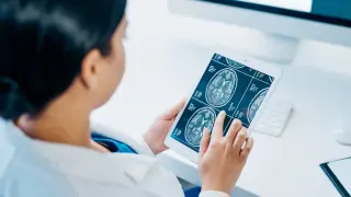 Una neuróloga interpreta una prueba de imagen cerebral.